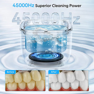 SAKER® Ultrasonic Retainer Cleaner